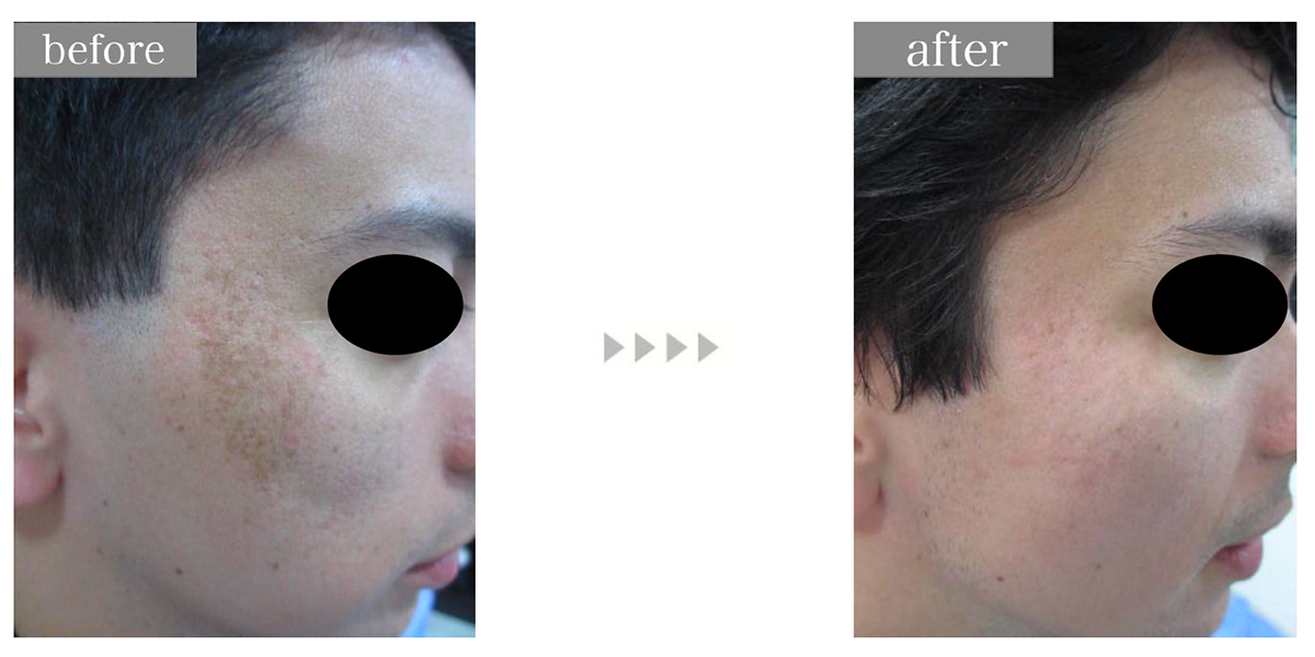 Hollywood Toning