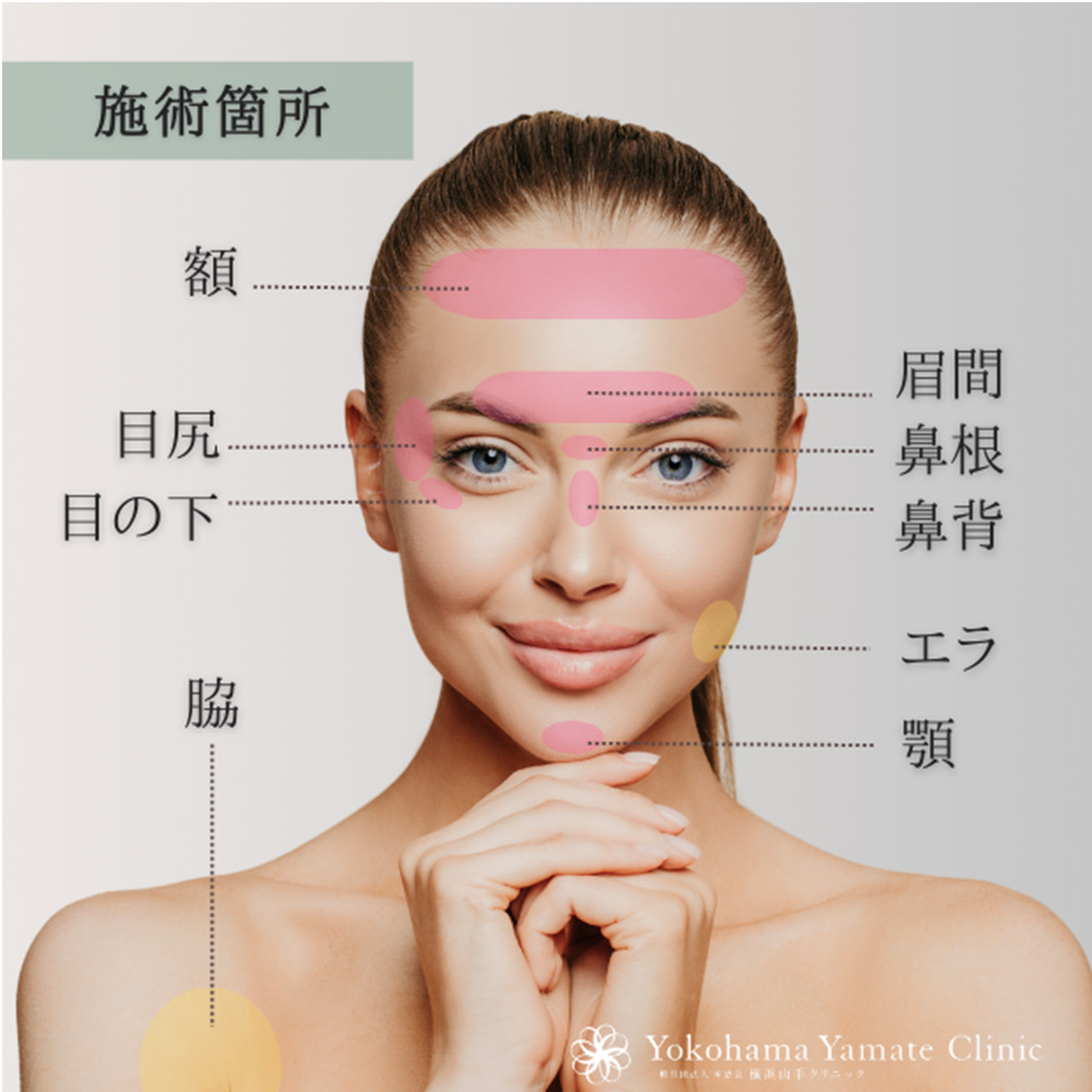 Botox Injections