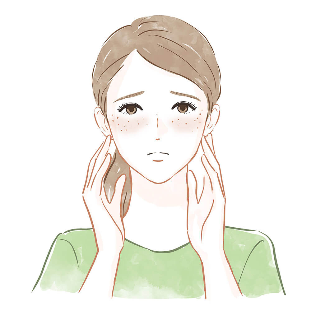 Melasma