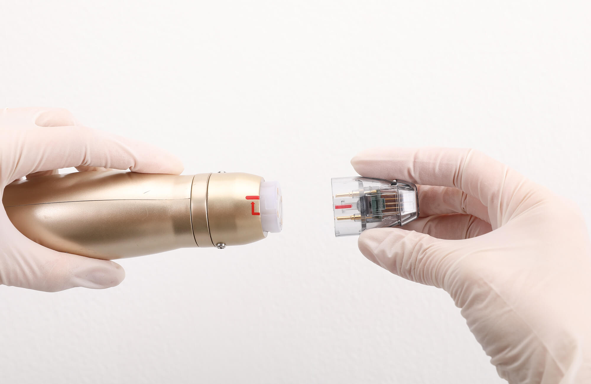 Fractional Needle RF
