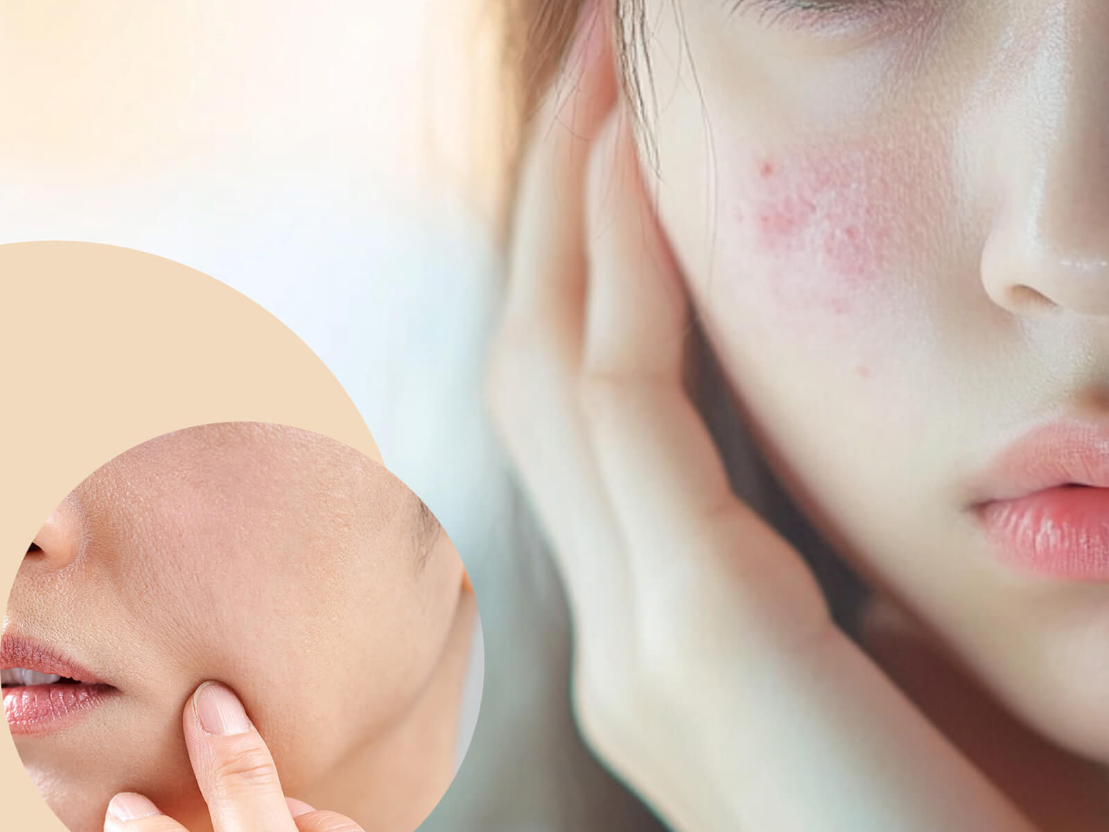 大人の肌荒れセット