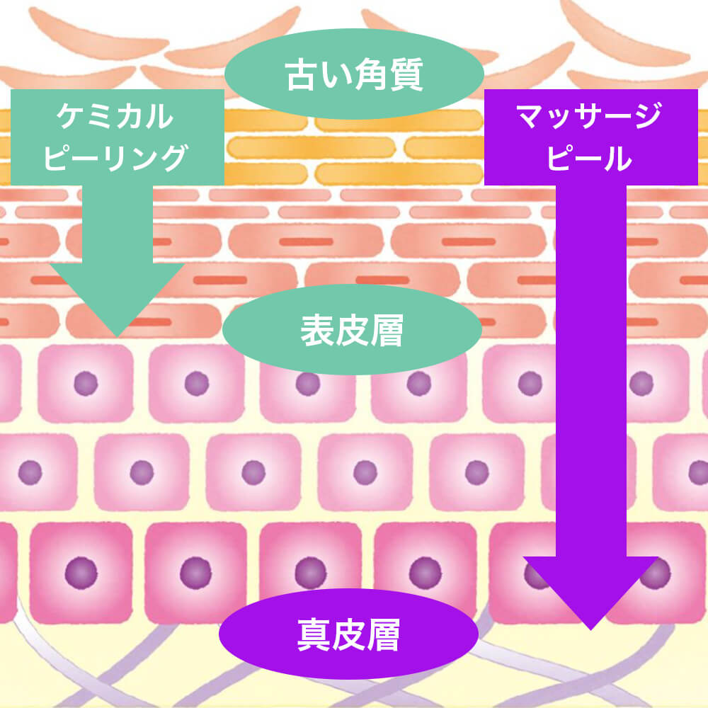 マッサージピール