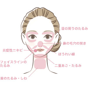 シルファーム X