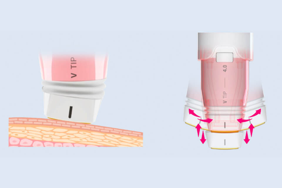 ボルニューマー