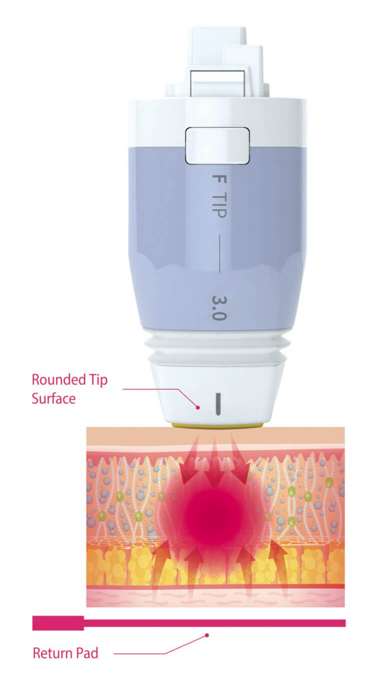 ボルニューマー