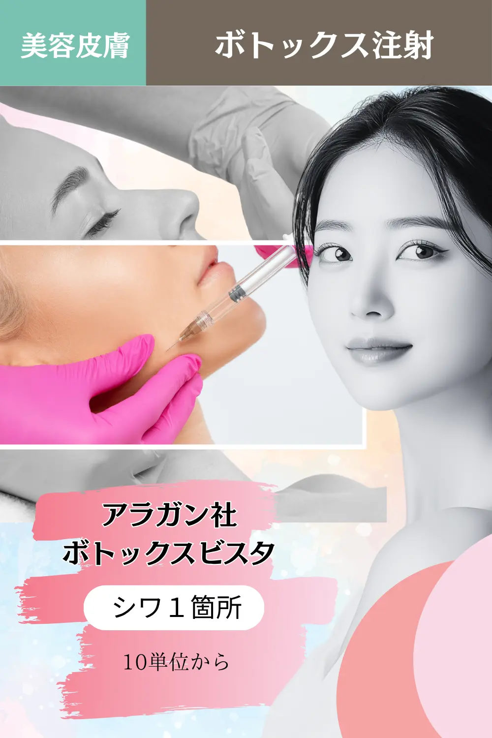 ボトックス
