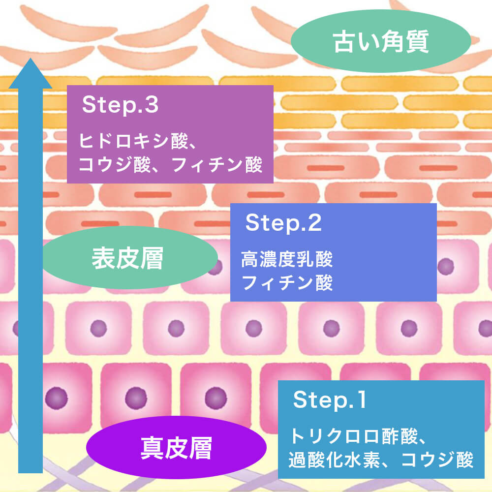 逆轉剝離